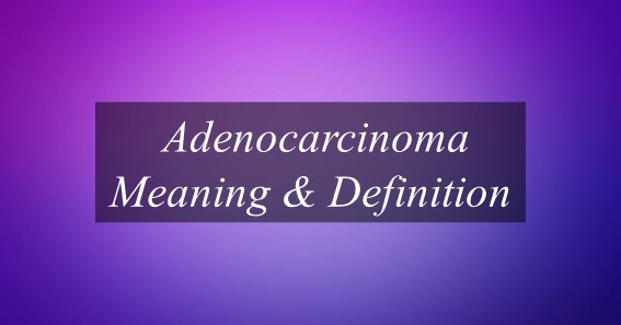 Adenocarcinoma Meaning & Definition;