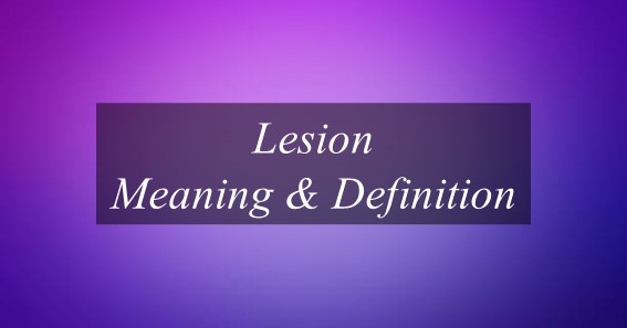 what-is-the-meaning-of-lesion-find-out-meaning-of-lesion